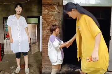 World's tallest woman died at 23